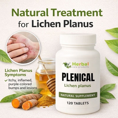 Herbal-Remedies-for-Lichen-Planus.jpg